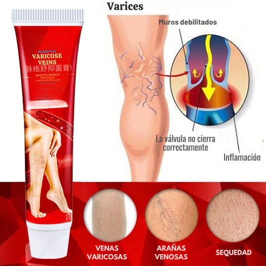 Crema para varices