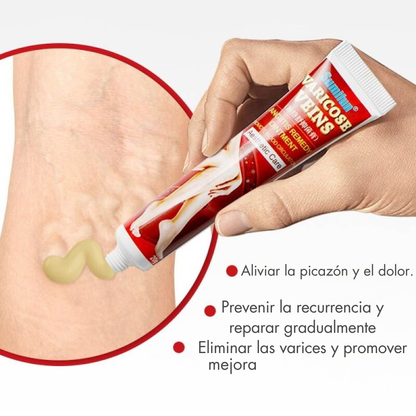 Crema para varices