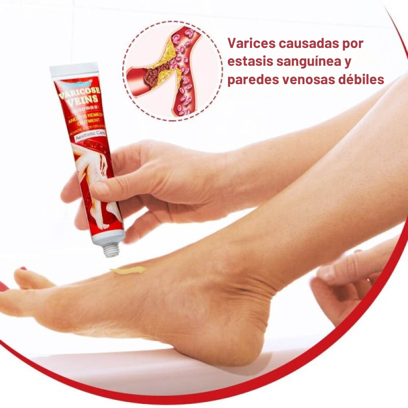 Crema para varices